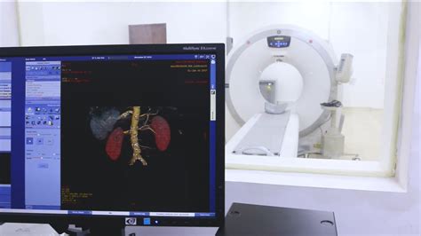 Computerized Tomography Ct Scan Global Care Medical Center Of Talisay