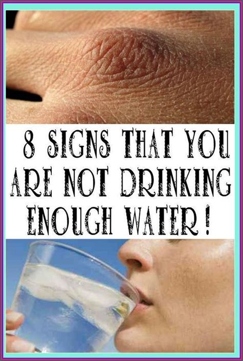 10 Signs You Are Not Drinking Enough Water Metodije Ilic Artofit