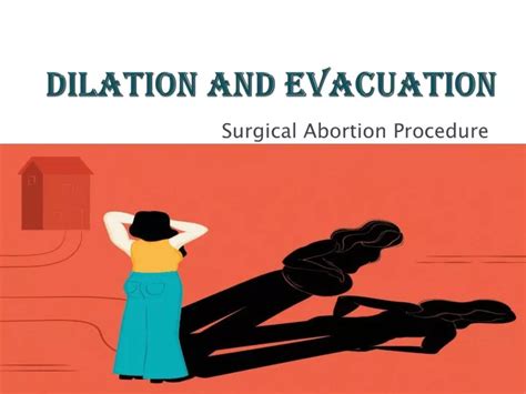 PPT - Dilation and Evacuation – Surgical Abortion Procedure PowerPoint ...