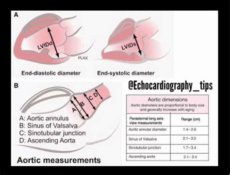 Aortic Measurements Perfusfind