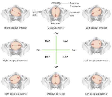 Vertex Position Fetal Position In