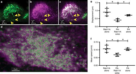 Two Color Imaging Of Pa Mruby Infected Gfp Rab A Cells A Cells