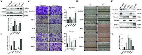 Sirt2 Is Elevated In Osteosarcoma Cells A Western Blot Was Used To