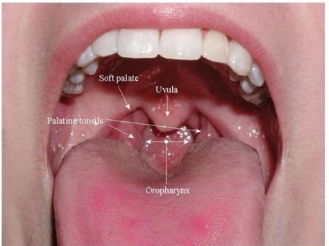 Anatomy Of Pharynx