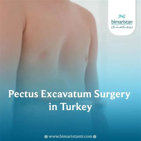 Pectus excavatum treatment in Turkey بيمارستان