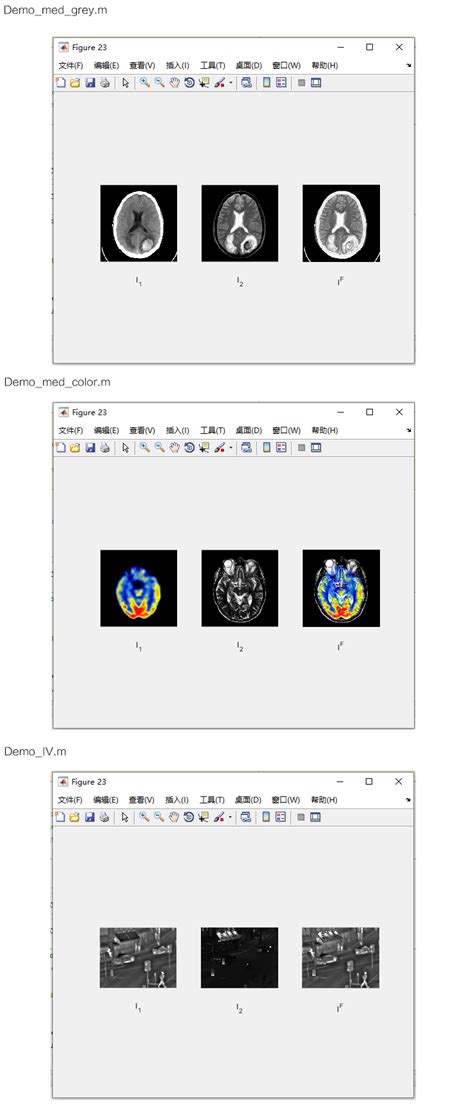 【b190】基于matlab医学图像融合仿真 图像处理 索炜达电子
