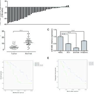 Downregulation Of MiR 495 In ESCC And Its Correlation With Clinical