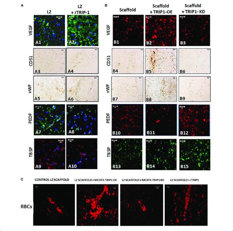 TRIP 1 Promotes Angiogenesis In Vivo A Effect Of RTRIP 1 Adsorbed