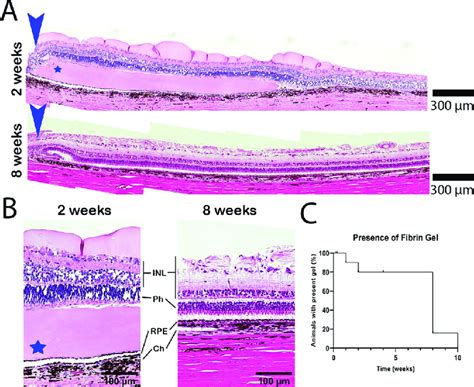 Fibrin Implantation Histology A Photomicrograph Of H E Stained