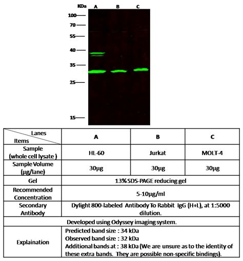 Recombinant Anti BAFF BLyS TNFSF13B Antibody Rabbit MAb 10056 R182