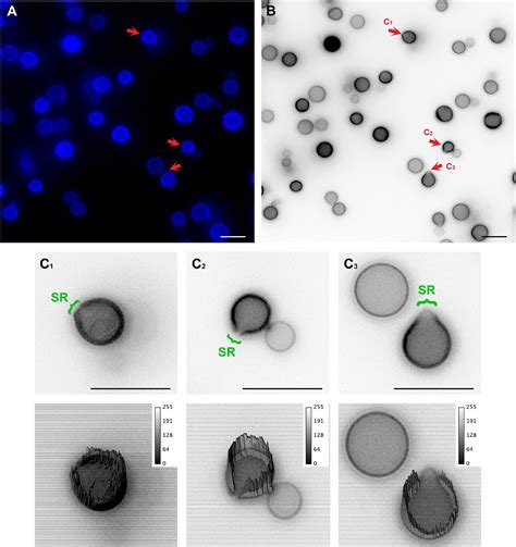 Frontiers Ultrastructural Study Of Cryptococcus Neoformans Surface