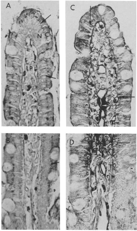 Immunoperoxidase Localization Of Apoc In Rat Jejunum The Top A