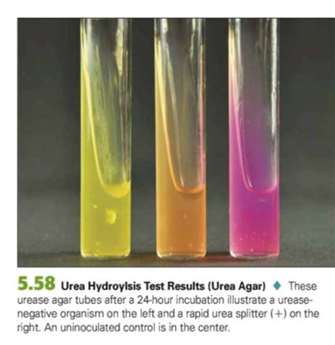 Urea Agar Results