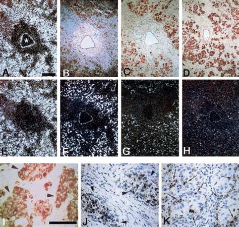 The R X Mutation Of The Sdhd Gene In Hereditary Paraganglioma