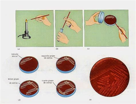 T Cnicas Y M Todos De Estriado En Caja Y Tubo Medios De Cultivo