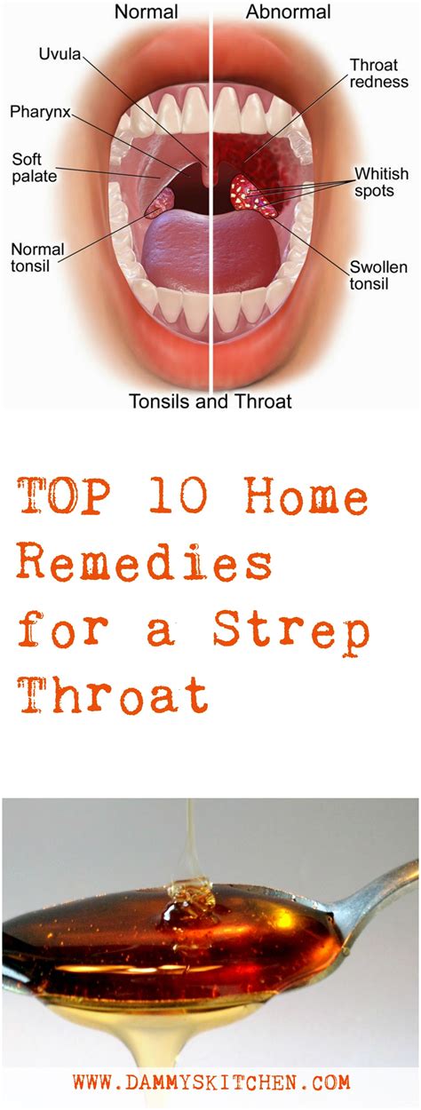 Herbal Medicine For Strep Throat Best Herbal