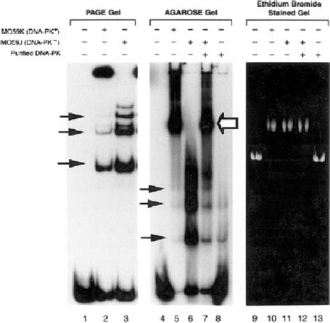 A Large Dnaprotein Complex Is Resolved By An Agarose Gel Emsa And Its