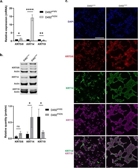 Overexpression Of Pxdn In D492 Enforced Epithelial Basal Phenotype A Download Scientific