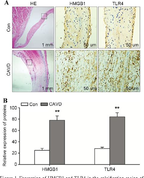 Figure From High Mobility Group Box Induces Calcification Of Aortic