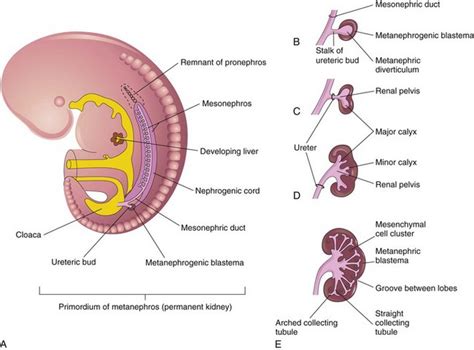 Embryology Anatomy And Variants Of The Genitourinary Tract