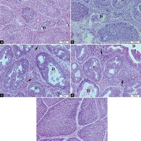 Representative Photomicrographs Of Spleen Histopathology A