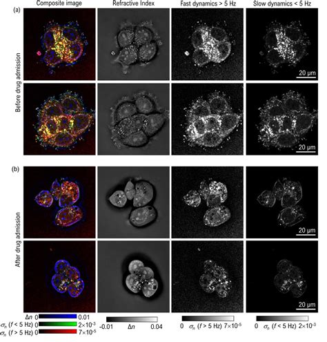 Figure 1 From Improving Specificity And Axial Spatial Resolution Of