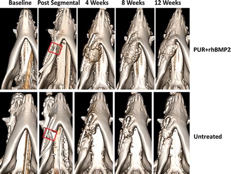 Submandibular view of 3D reconstructed 64‐slice CT scan series over the ...