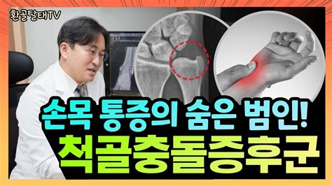 Ep13 손목 통증의 숨은 범인 👋 척골충돌증후군을 들어보셨나요 척골충돌증후군이란 한국인에게 흔한 척골양성변이 손목