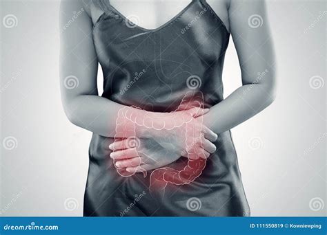 Ulcerative Colitis Uc Intestine Stock Image Image Of Inflammation