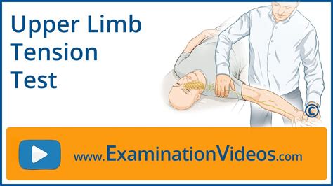 Upper Limb Tension Test YouTube