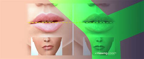 How To Fix Uneven Lips Expert Tips For Symmetrical Smile Mewing Coach