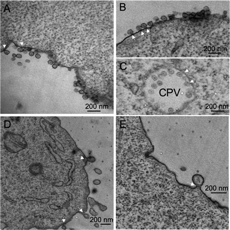 Thin Section Tem Of Cells Infected With Vlvs A And B Examples Of