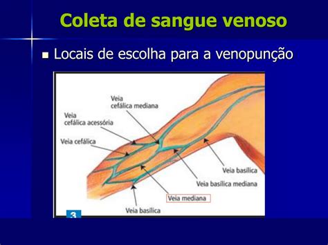 Locais Para Pun O Venosa Librain