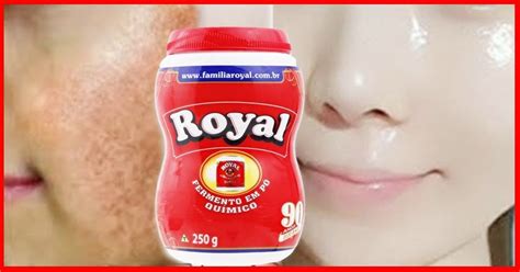 Como Usar O P Royal Para Remover Manchas Escuras Nas Pele B