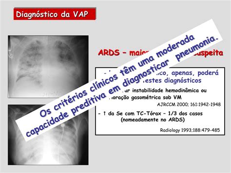 Ppt Pneumonia Associada Ventila O Valor Diagn Stico Pcr E Pct