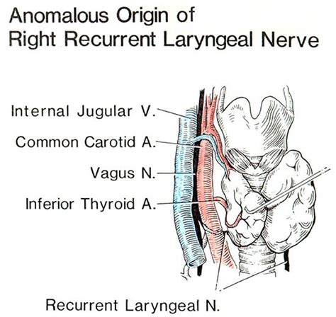 Anomalous Origin Of Right Recurrent Laryngeal Nerve As Found At