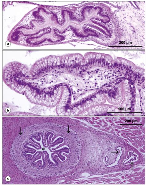 Common Bile Duct Histology