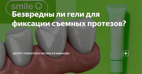 Безвредны ли гели для фиксации съемных протезов? | Центр стоматологии ...