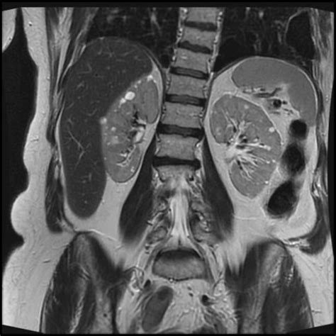 Imagenolog A Del Sistema Urinario Concise Medical Knowledge