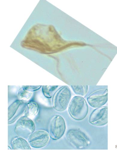 Protozoa Flashcards Quizlet