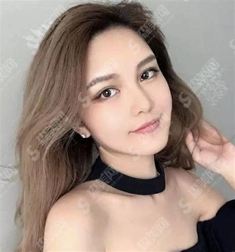 Zhou Yangqing Could See The Plastic Surgery At A Glance All Beautiful