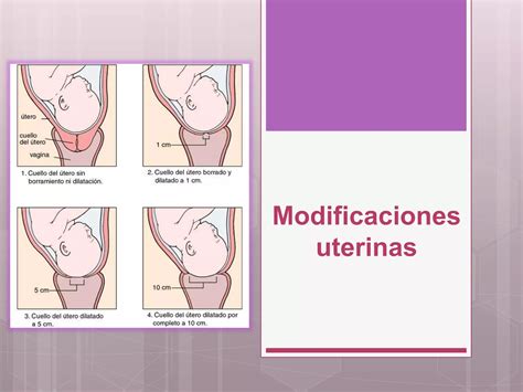 Modificaciones Gravidicas Locales Pptx