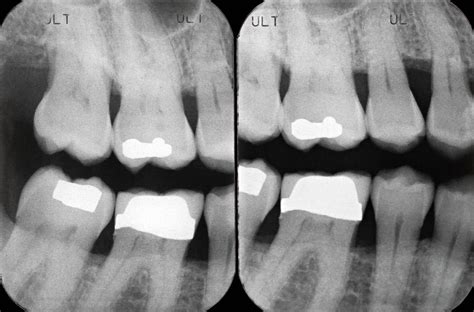 Melissa Says Along With A Dental Examination Dental X Rays Are An