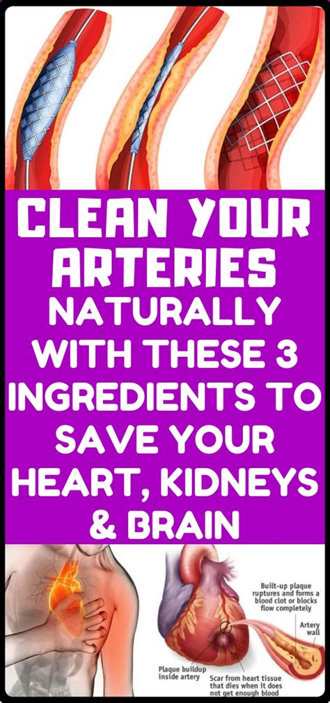 How to clean out plaque in arteries – 3 ingredients mixture - Skiniez ...