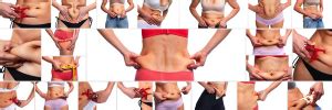 Plastyka Pow Ok Brzucha Abdominoplastyka Chirurgia Plastyczna