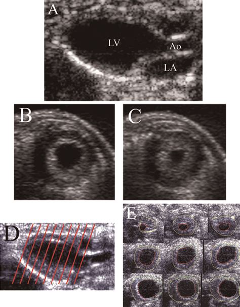 B Mode Recordings Of Normal Adult Wild Type Mice A 2d Parasternal