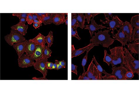 Muc Ac E O I Xp Rabbit Mab Bsa And Azide Free Cell Signaling