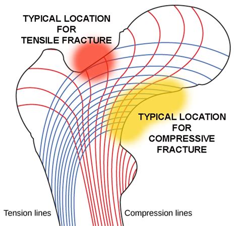 Sports Injury Bulletin Diagnose Treat Uncommon Injuries Don T