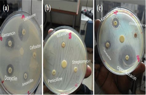 Antibiotic Susceptibility Pattern Of Shigella Isolates Against 11 Download Scientific Diagram