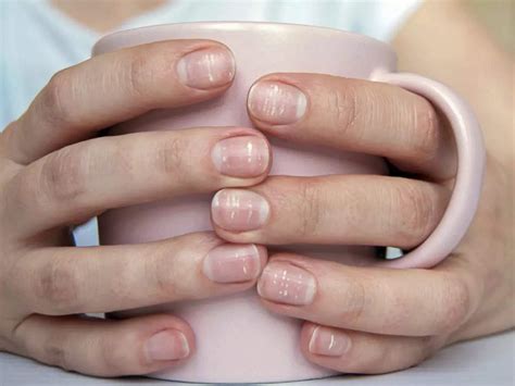 Calcium Deficiency Symptoms Common Signs And Symptoms Of Calcium